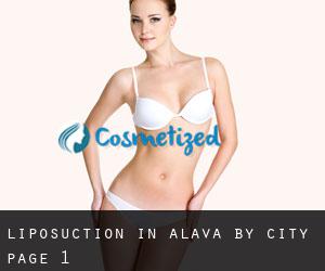 Liposuction in Alava by city - page 1