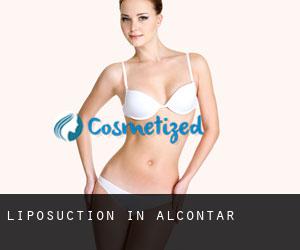 Liposuction in Alcóntar