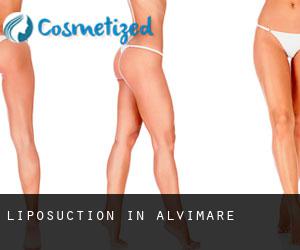 Liposuction in Alvimare