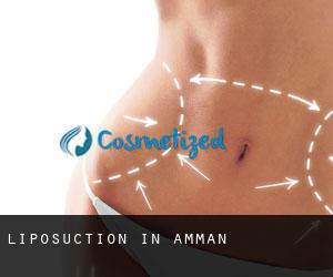 Liposuction in Amman