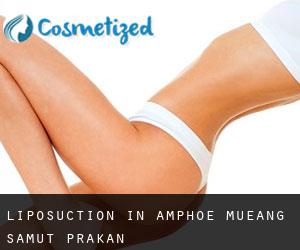 Liposuction in Amphoe Mueang Samut Prakan