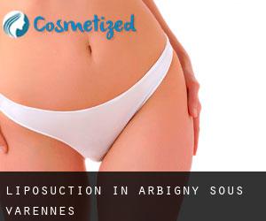 Liposuction in Arbigny-sous-Varennes