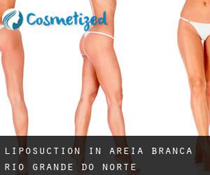 Liposuction in Areia Branca (Rio Grande do Norte)