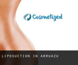 Liposuction in Arruazu