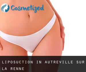 Liposuction in Autreville-sur-la-Renne