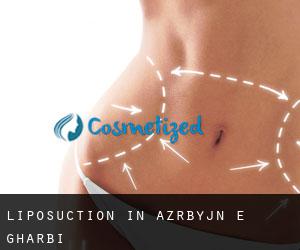 Liposuction in Āz̄ārbāyjān-e Gharbī