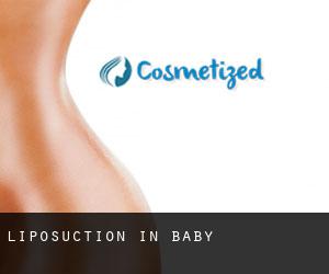Liposuction in Baby