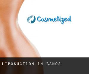 Liposuction in Baños