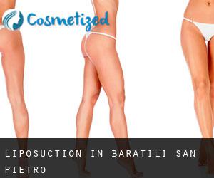 Liposuction in Baratili San Pietro