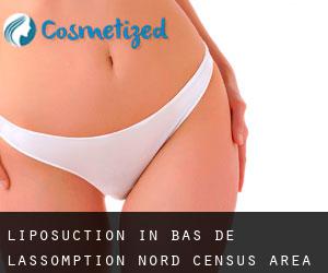 Liposuction in Bas-de-L'Assomption-Nord (census area)
