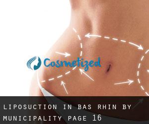Liposuction in Bas-Rhin by municipality - page 16