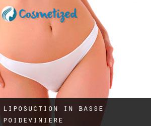 Liposuction in Basse Poidevinière
