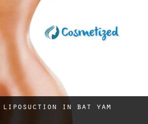 Liposuction in Bat Yam