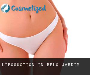 Liposuction in Belo Jardim