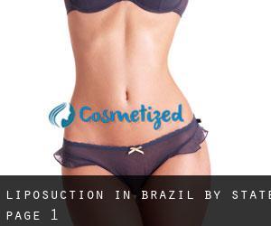 Liposuction in Brazil by State - page 1