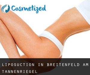 Liposuction in Breitenfeld am Tannenriegel