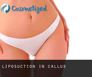 Liposuction in Callús