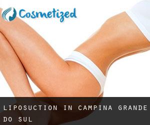 Liposuction in Campina Grande do Sul