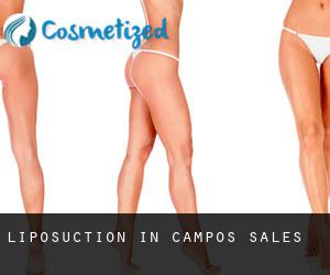 Liposuction in Campos Sales