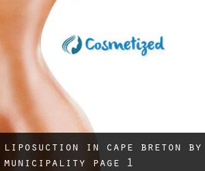 Liposuction in Cape Breton by municipality - page 1