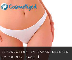 Liposuction in Caraş-Severin by County - page 1