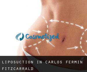 Liposuction in Carlos Fermin Fitzcarrald