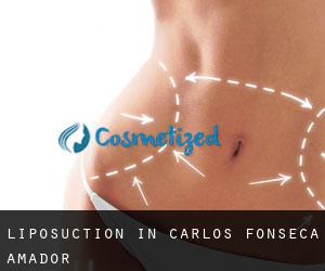 Liposuction in Carlos Fonseca Amador