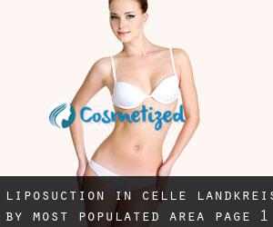 Liposuction in Celle Landkreis by most populated area - page 1