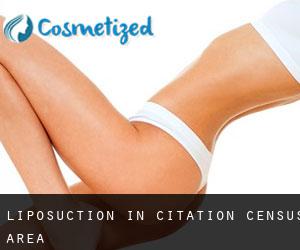 Liposuction in Citation (census area)