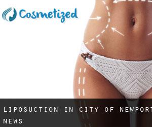 Liposuction in City of Newport News