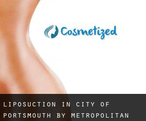 Liposuction in City of Portsmouth by metropolitan area - page 1