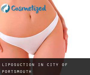 Liposuction in City of Portsmouth