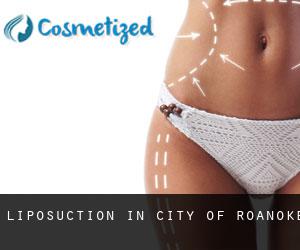 Liposuction in City of Roanoke