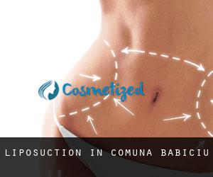 Liposuction in Comuna Băbiciu