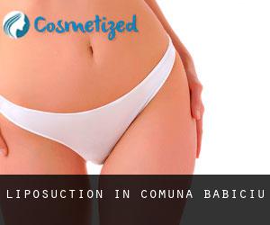 Liposuction in Comuna Băbiciu