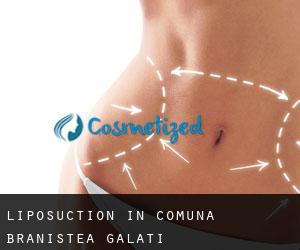 Liposuction in Comuna Braniştea (Galaţi)