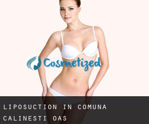 Liposuction in Comuna Cãlineşti-Oaş