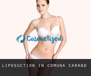 Liposuction in Comuna Cărand