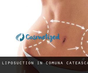 Liposuction in Comuna Căteasca