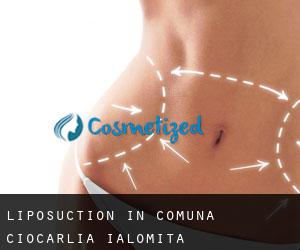 Liposuction in Comuna Ciocârlia (Ialomiţa)