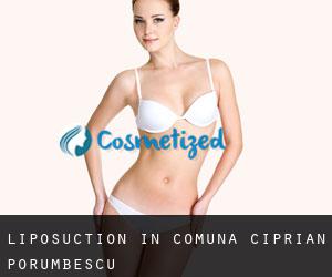 Liposuction in Comuna Ciprian Porumbescu
