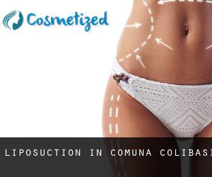 Liposuction in Comuna Colibaşi