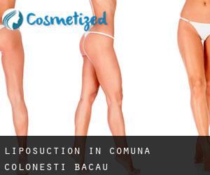 Liposuction in Comuna Coloneşti (Bacău)