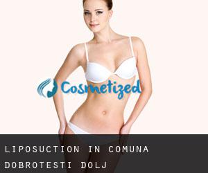 Liposuction in Comuna Dobroteşti (Dolj)