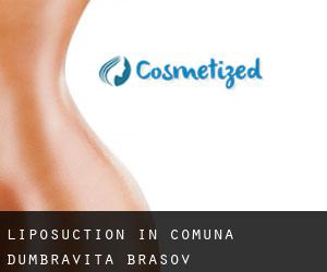 Liposuction in Comuna Dumbrăviţa (Braşov)