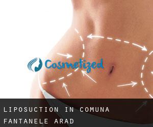Liposuction in Comuna Fântânele (Arad)