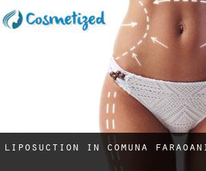 Liposuction in Comuna Faraoani
