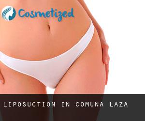 Liposuction in Comuna Laza
