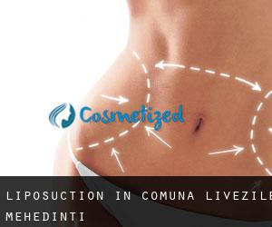 Liposuction in Comuna Livezile (Mehedinţi)