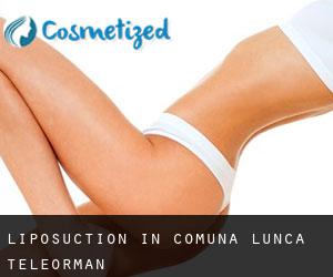 Liposuction in Comuna Lunca (Teleorman)